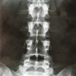 X-ray